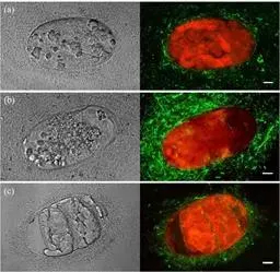 Atividade antag&ocirc;nica de Bacillus firmus